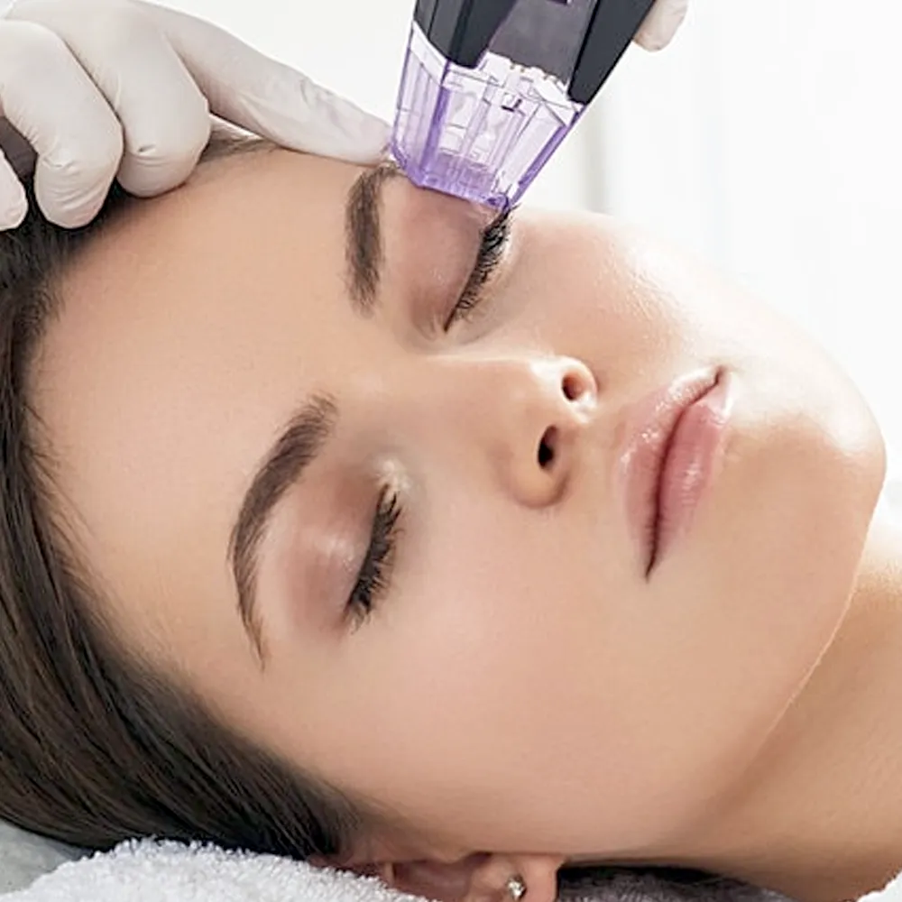 A woman receiving Morpheus8 cosmetic treatment.