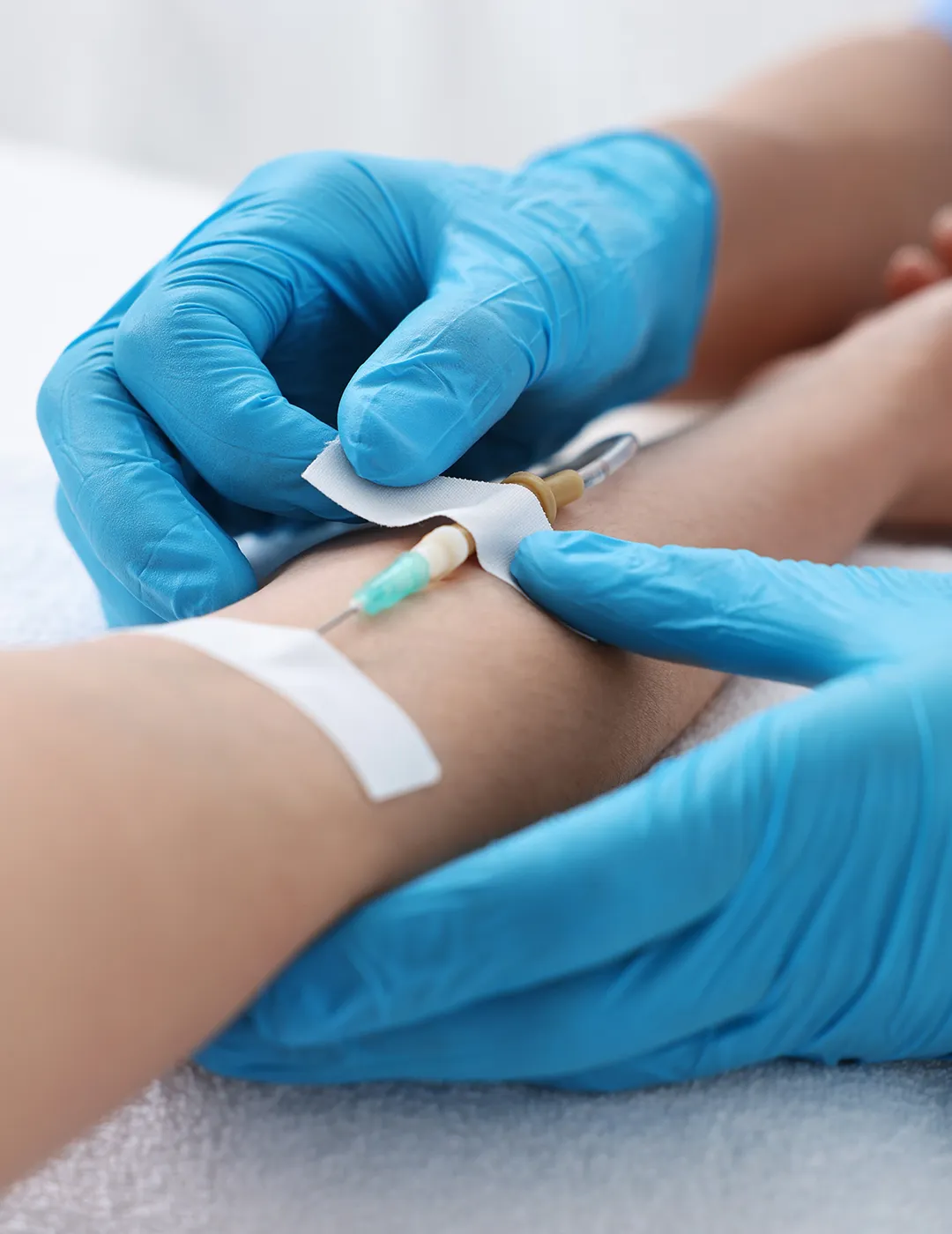 Blue-gloved hands inserting an IV into a patient’s arm.