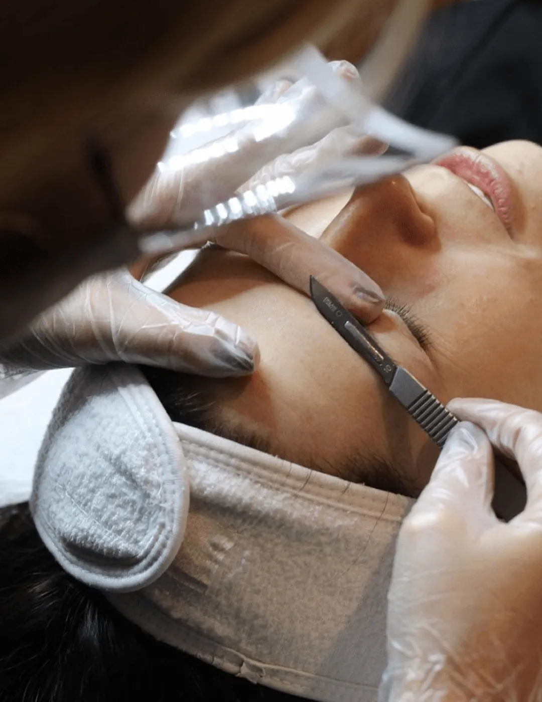 A woman receiving dermaplaning treatment.