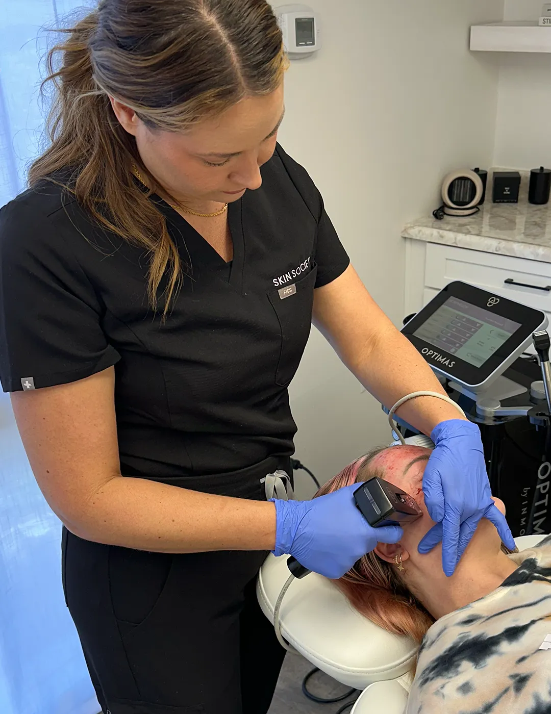 A patient receiving a Morpheus8 treatment.