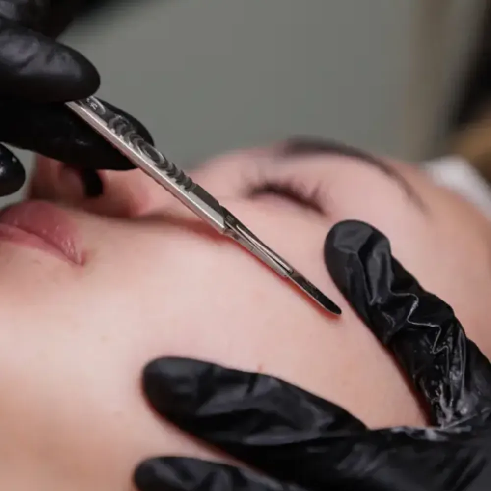 A woman receiving dermaplaning treatment.