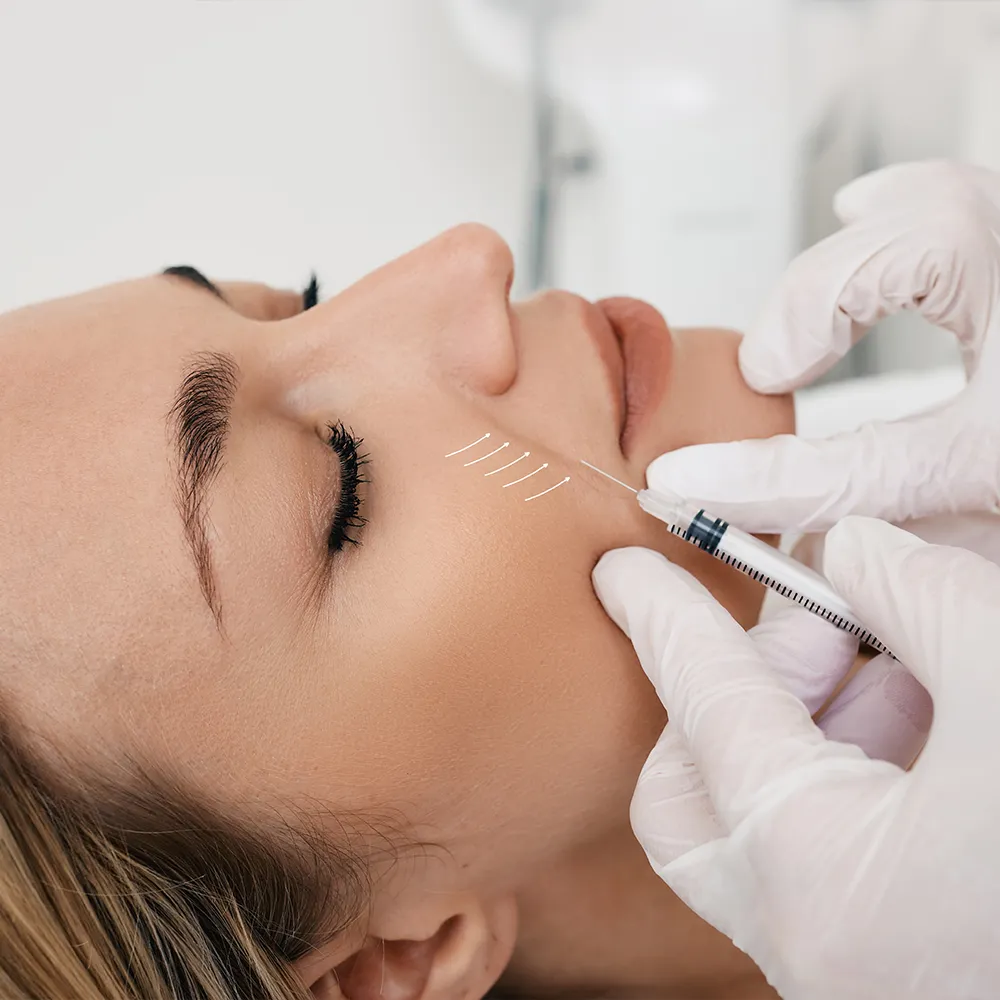 A woman receiving dermal filler injections in her face.