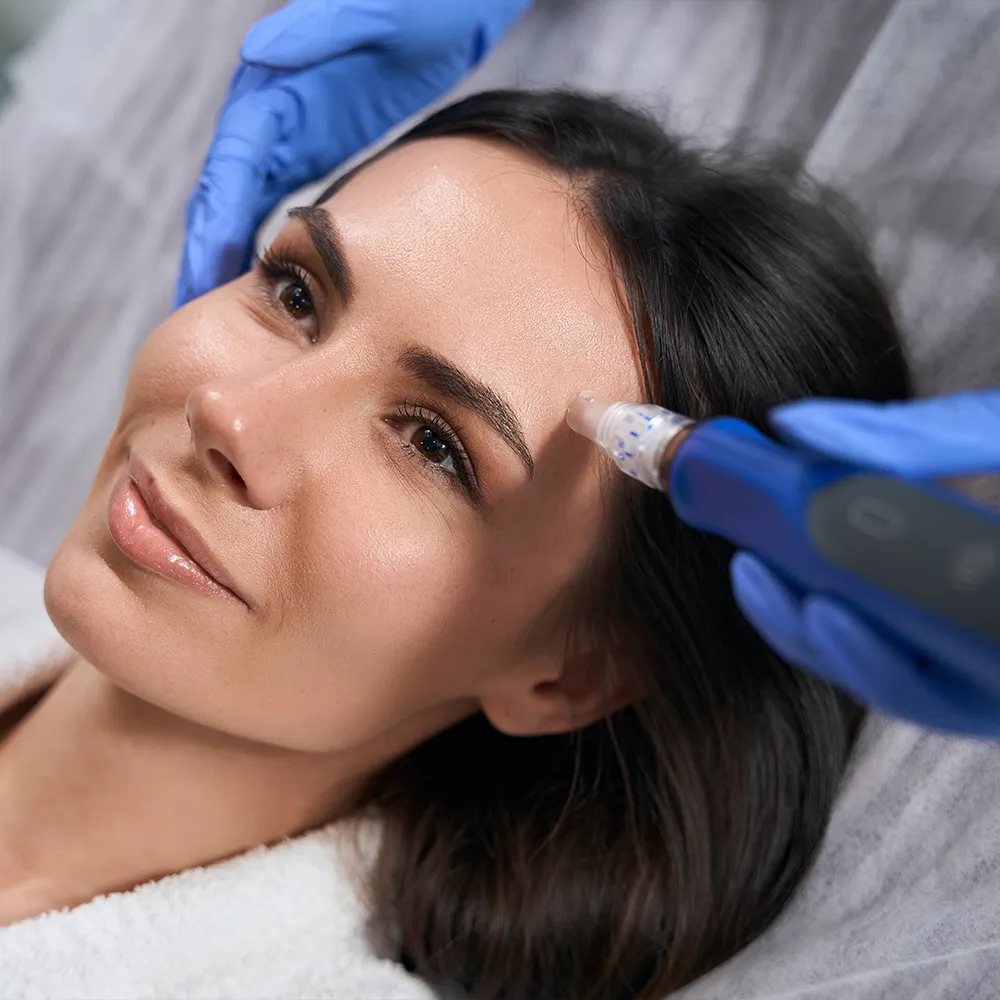 A woman receiving microneedling treatment.