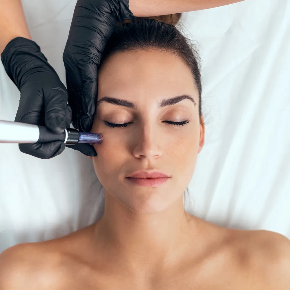 A woman receiving a microneedling facial treatment.