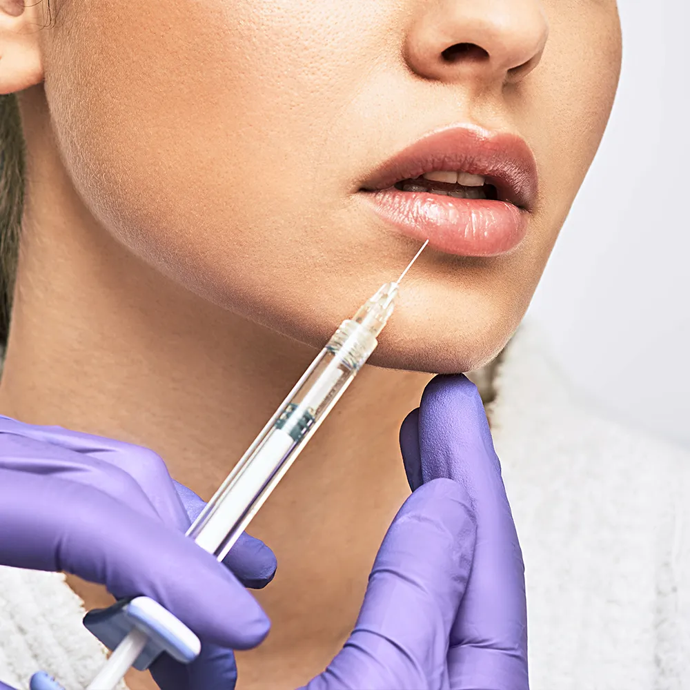 A woman receiving dermal filler injections in her face.